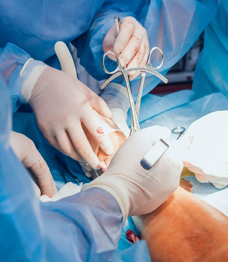 Orthopedic Tools